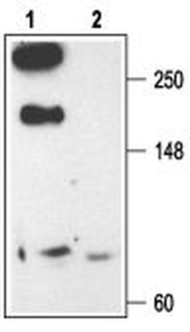 CaV2.3 (CACNA1E) Antibody in Western Blot (WB)