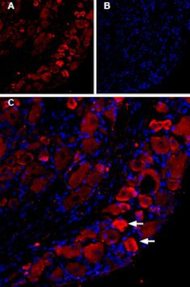 TRPV1 (VR1) Antibody in Immunohistochemistry (IHC)