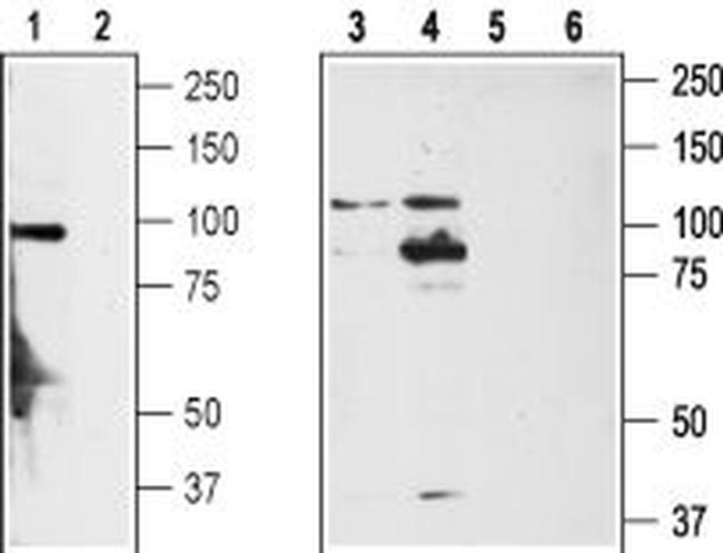TRPA1 (extracellular) Antibody in Western Blot (WB)