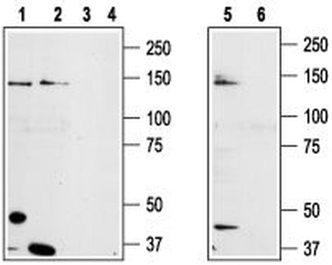TRPM8 (extracellular) Antibody in Western Blot (WB)