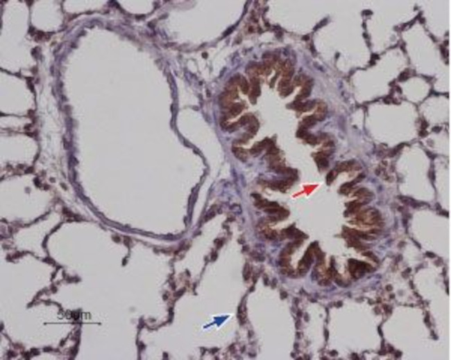 STIM2 Antibody in Immunohistochemistry (Paraffin) (IHC (P))