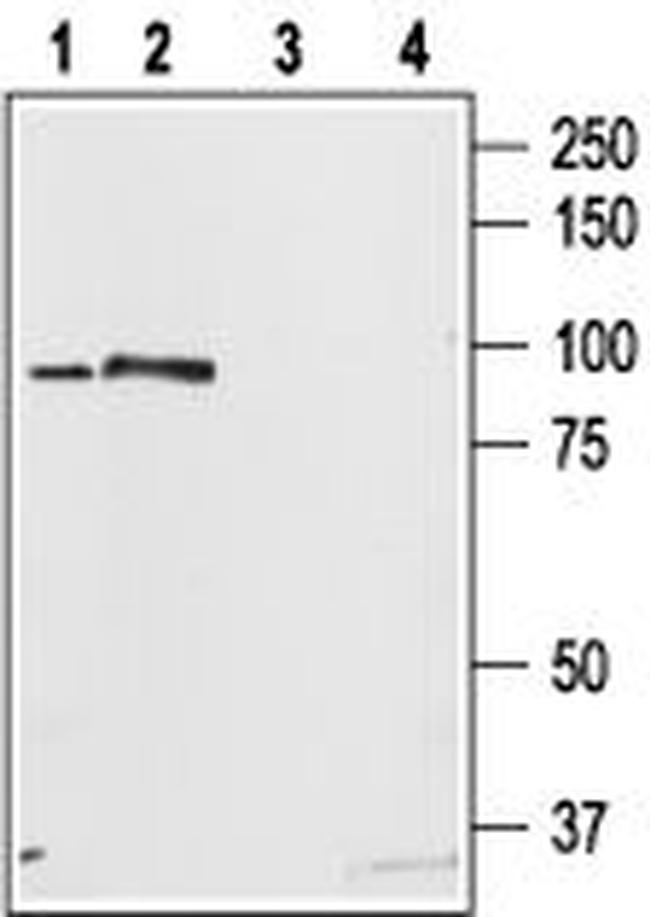 STIM2 Antibody in Western Blot (WB)