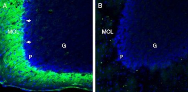 TMEM66 Antibody in Immunohistochemistry (Frozen) (IHC (F))