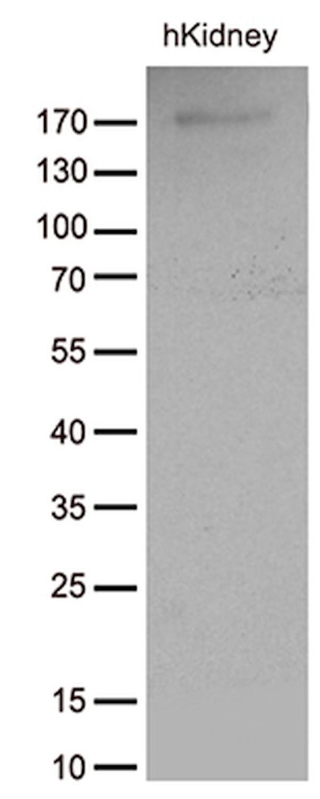 ACE Antibody in Western Blot (WB)