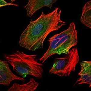 ATP Citrate Lyase Antibody in Immunocytochemistry (ICC/IF)