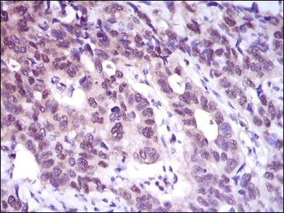 ATP Citrate Lyase Antibody in Immunohistochemistry (Paraffin) (IHC (P))