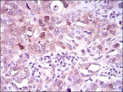 ATP Citrate Lyase Antibody in Immunohistochemistry (Paraffin) (IHC (P))