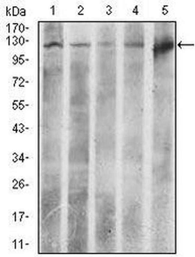 ATP Citrate Lyase Antibody in Western Blot (WB)