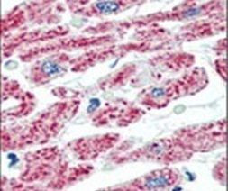 Aconitase 2 Antibody in Immunohistochemistry (IHC)