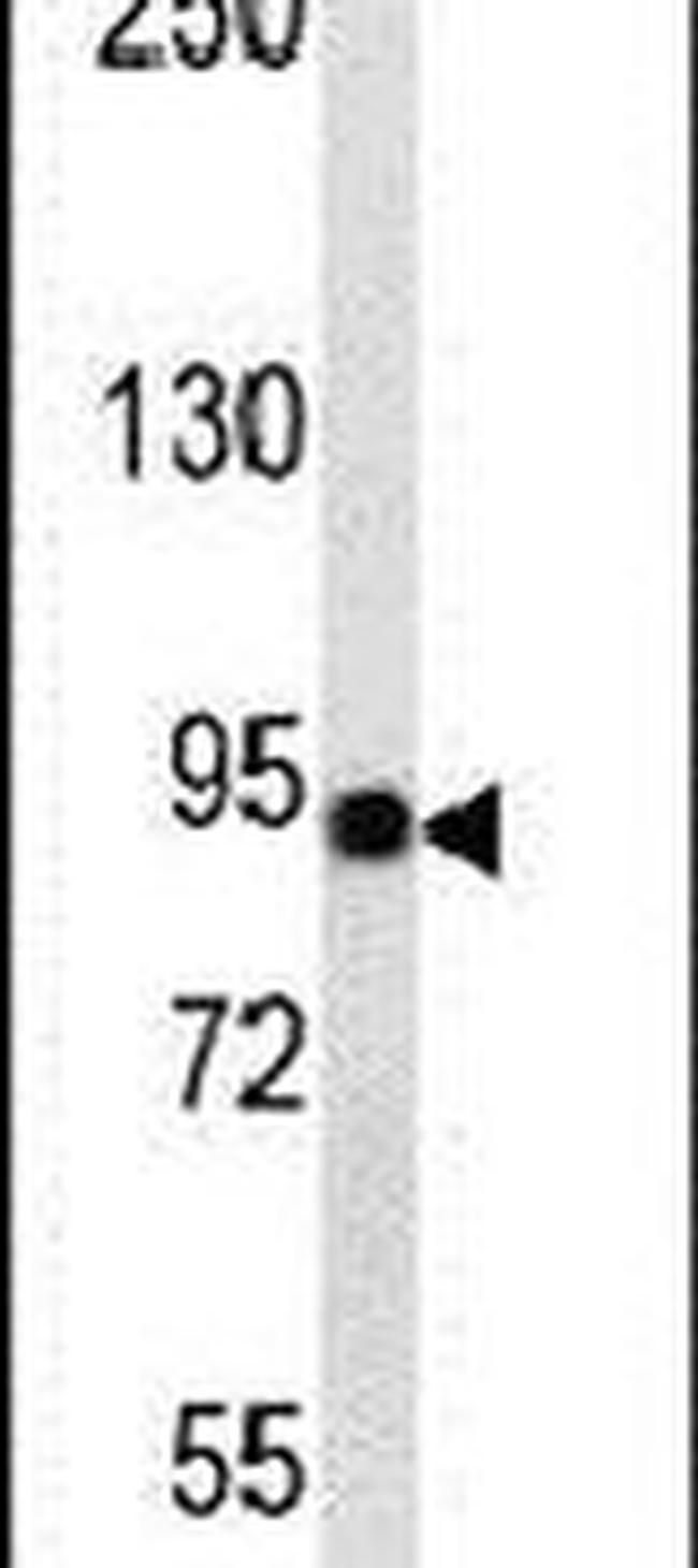 Aconitase 2 Antibody in Western Blot (WB)