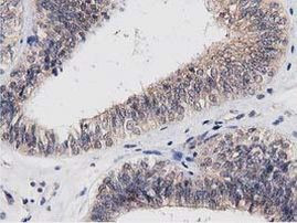 ACOT12 Antibody in Immunohistochemistry (Paraffin) (IHC (P))