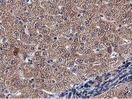 ACOT12 Antibody in Immunohistochemistry (Paraffin) (IHC (P))