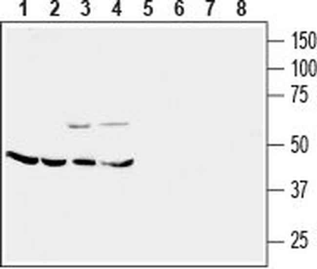 CRF2/CRHR2 (extracellular) Antibody in Western Blot (WB)