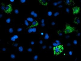 ACSM5 Antibody in Immunocytochemistry (ICC/IF)