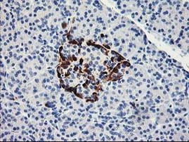 ACSS2 Antibody in Immunohistochemistry (Paraffin) (IHC (P))