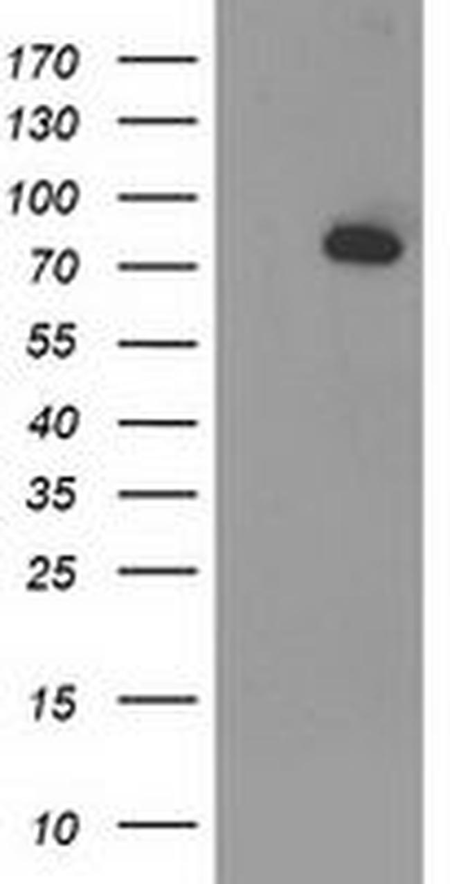 ACSS2 Antibody in Western Blot (WB)