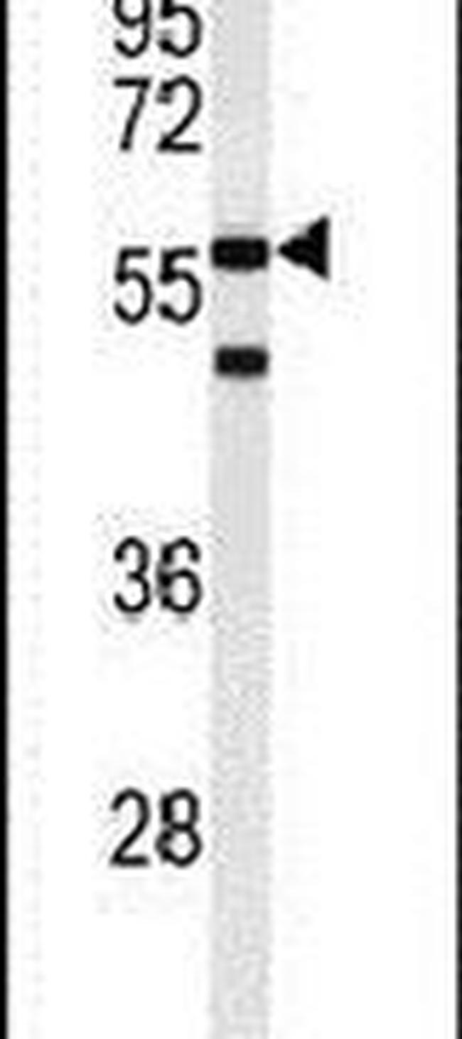 ACTR5 Antibody in Western Blot (WB)