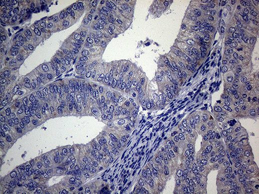 ACVR2A Antibody in Immunohistochemistry (Paraffin) (IHC (P))