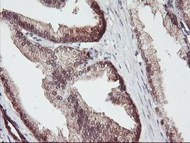 ACY1 Antibody in Immunohistochemistry (Paraffin) (IHC (P))