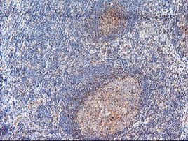 ACY1 Antibody in Immunohistochemistry (Paraffin) (IHC (P))