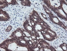 ACY1 Antibody in Immunohistochemistry (Paraffin) (IHC (P))