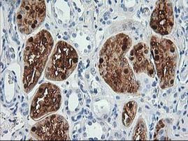 ACY1 Antibody in Immunohistochemistry (Paraffin) (IHC (P))