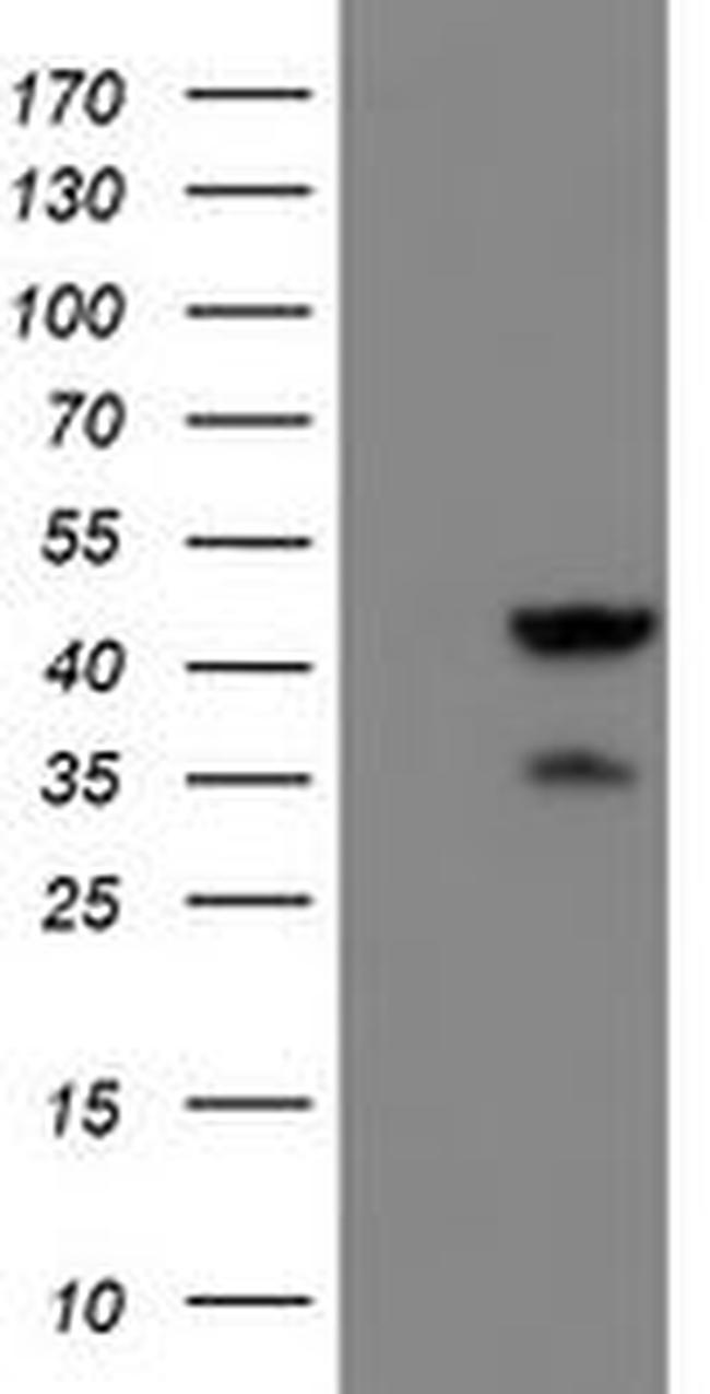 ACY1 Antibody in Western Blot (WB)