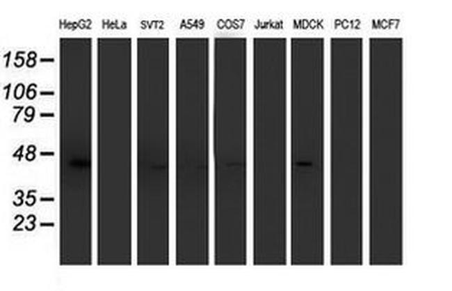 ACY1 Antibody in Western Blot (WB)