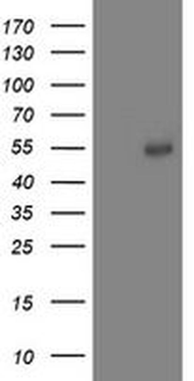 ACY1 Antibody in Western Blot (WB)