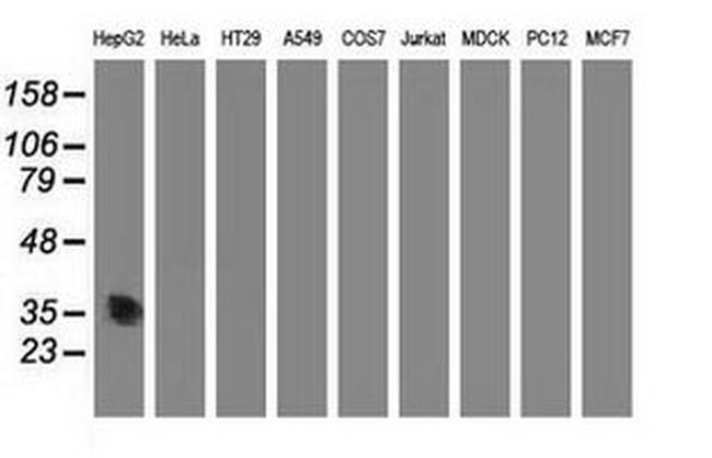 ACY3 Antibody in Western Blot (WB)