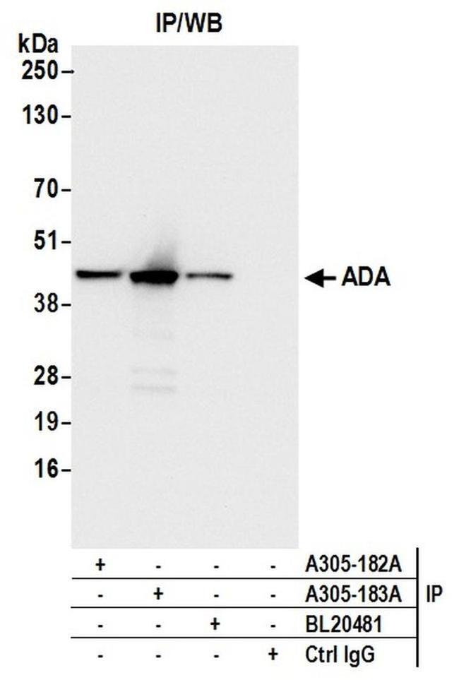 ADA/Adenosine Deaminase Antibody in Western Blot (WB)