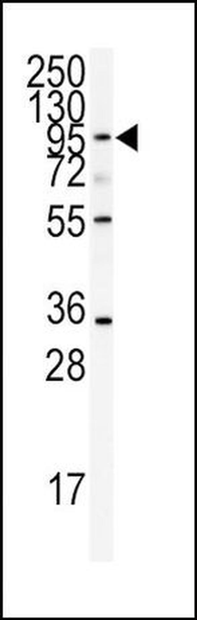 ADAMTS13 Antibody in Western Blot (WB)