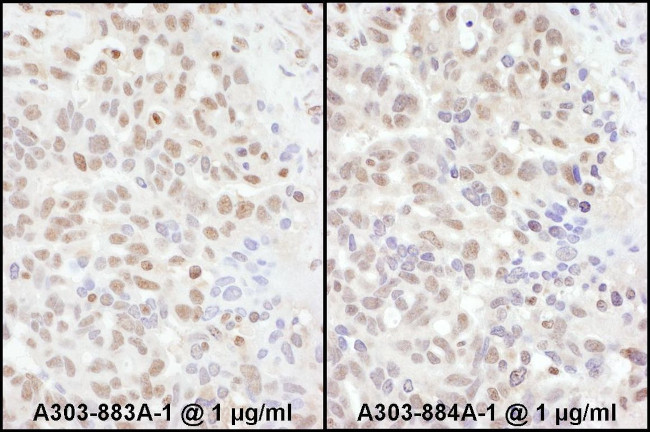 ADAR1 Antibody in Immunohistochemistry (IHC)