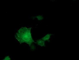 ADH1B Antibody in Immunocytochemistry (ICC/IF)