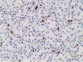 ADH1B Antibody in Immunohistochemistry (Paraffin) (IHC (P))