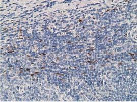 ADH1B Antibody in Immunohistochemistry (Paraffin) (IHC (P))