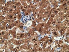 ADH1B Antibody in Immunohistochemistry (Paraffin) (IHC (P))