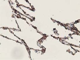 ADH1B Antibody in Immunohistochemistry (Paraffin) (IHC (P))