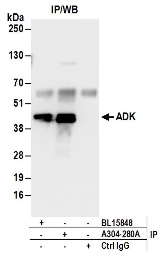 ADK Antibody in Western Blot (WB)