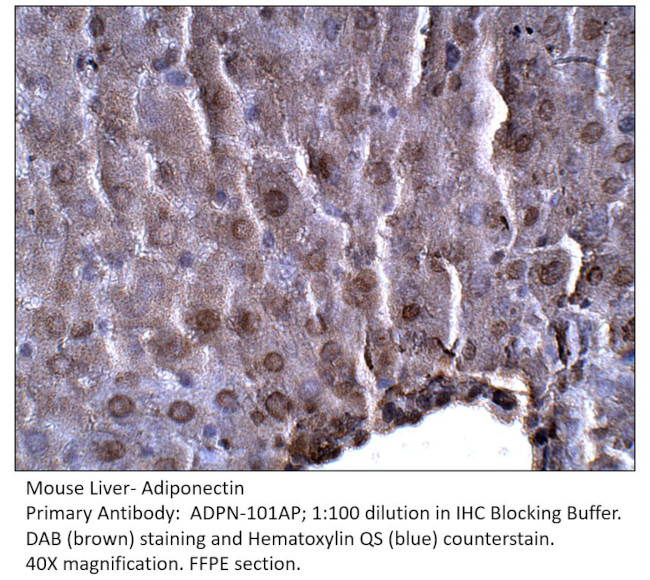 Adiponectin Antibody in Immunohistochemistry (IHC)