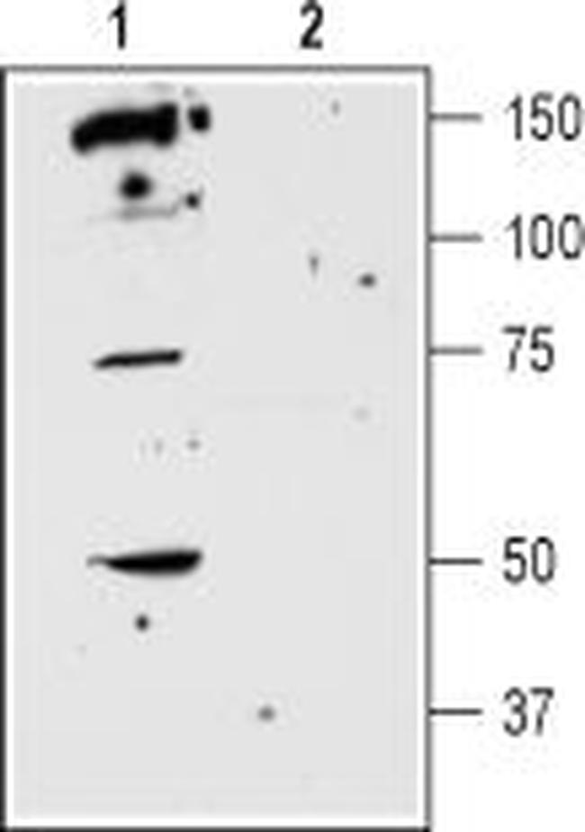 D5 Dopamine Receptor (extracellular) Antibody in Western Blot (WB)