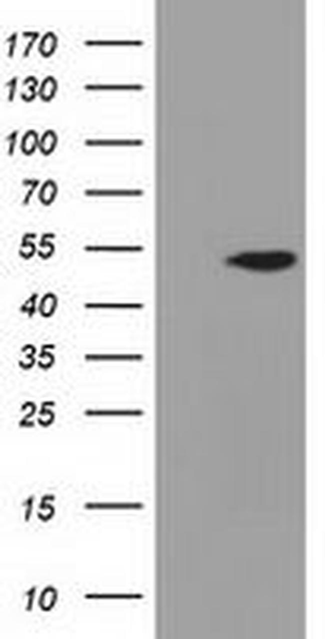 ADSL Antibody in Western Blot (WB)