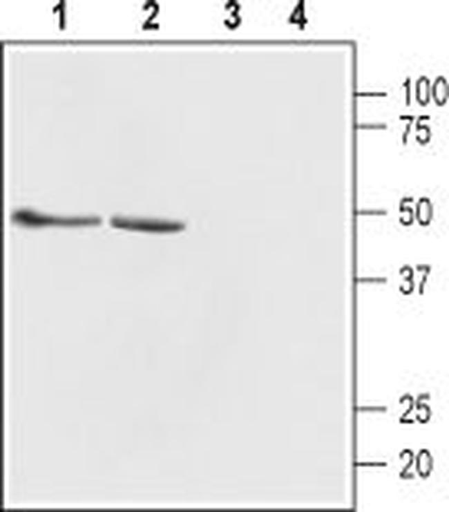 GABA(A) beta 1 Receptor Antibody in Western Blot (WB)