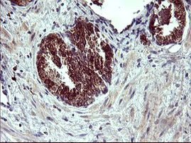 ARG2 Antibody in Immunohistochemistry (Paraffin) (IHC (P))