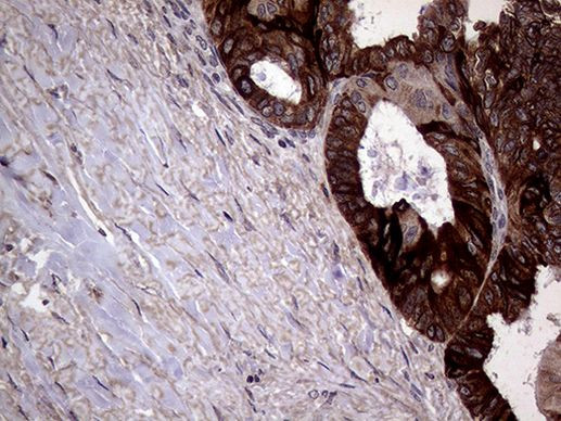 AGR2 Antibody in Immunohistochemistry (Paraffin) (IHC (P))