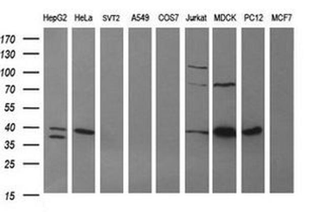 ARG2 Antibody in Western Blot (WB)