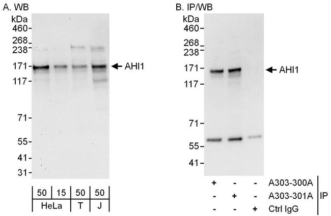 AHI1 Antibody in Western Blot (WB)