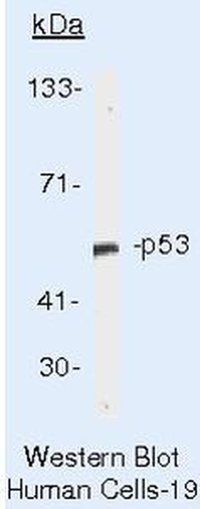 p53 Antibody in Western Blot (WB)