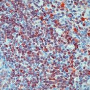 GRB2 Antibody in Immunohistochemistry (Paraffin) (IHC (P))