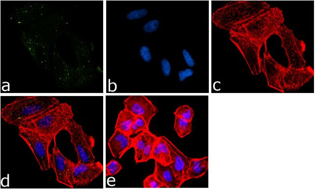 EIF2S1 Antibody in Immunocytochemistry (ICC/IF)